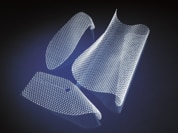 CN_Surgery_0117010